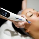 DERMAPEN 4 (Microneedling)